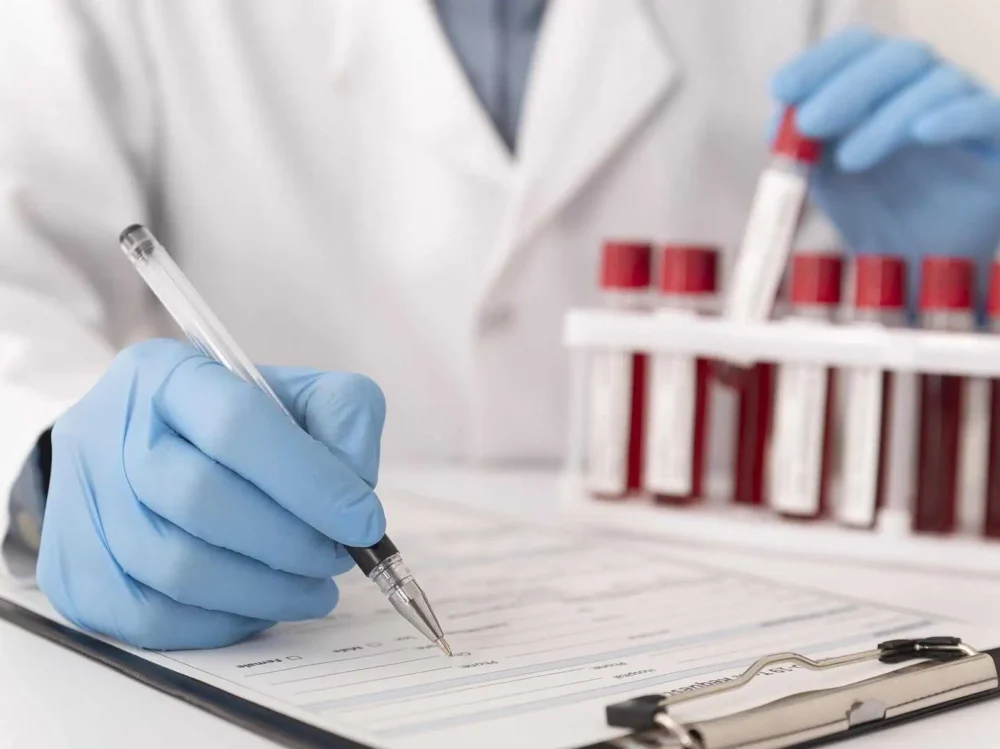 Understanding Your Blood Test Results: A Simple Guide Understanding Your Blood Test Results: A Simple Guide